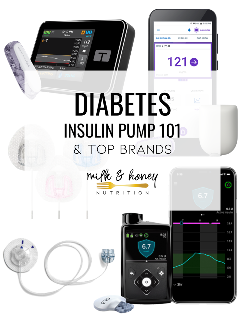 Diabetes Insulin Pump 101 & Top Brands
